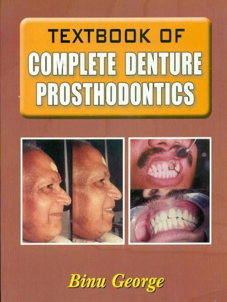 Stewarts Clinical Removable Partial Prosthodontics 4th Edition Pdf